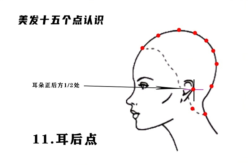 耳后点.png